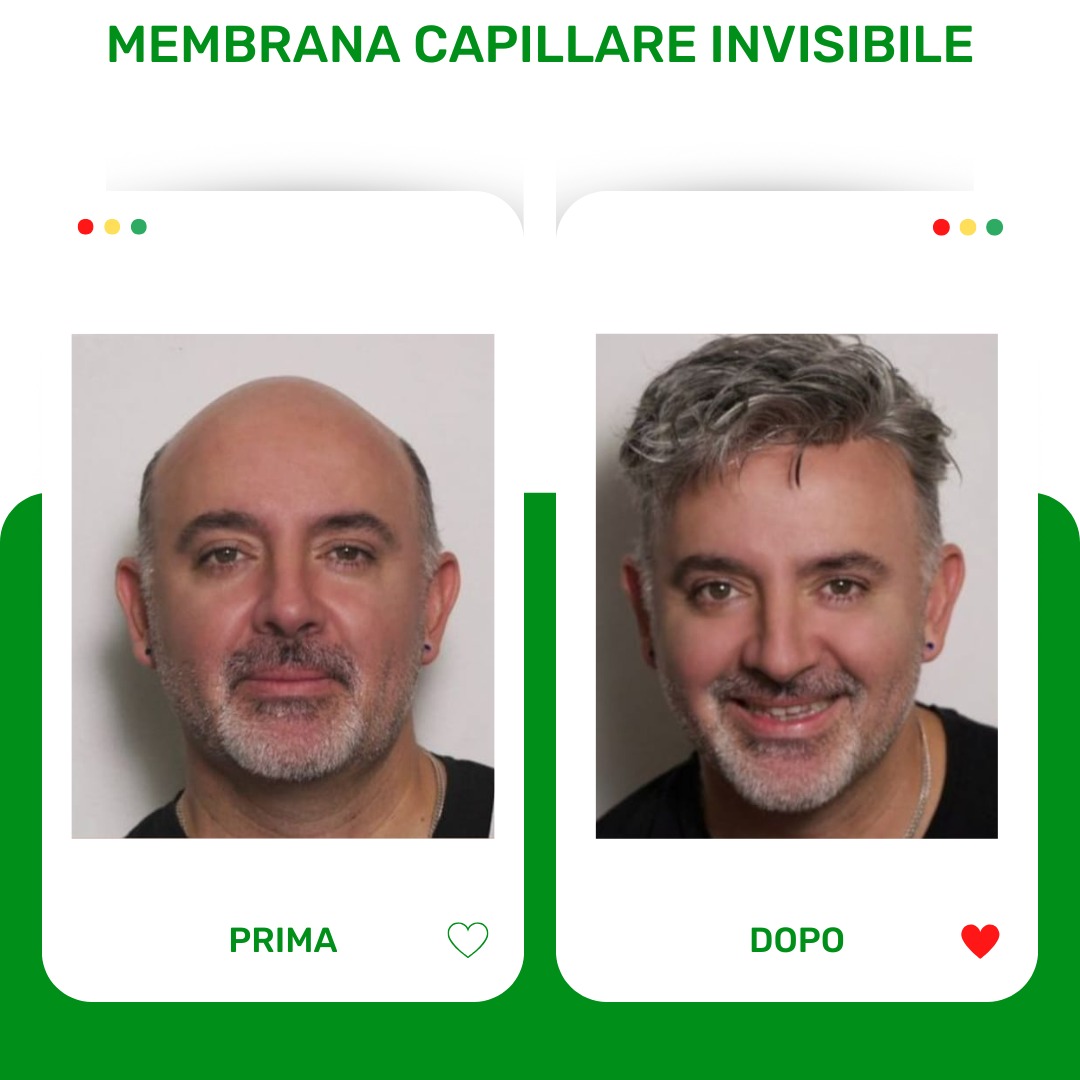 Membrana Capillare Invisibile Medical Capelli Palermo