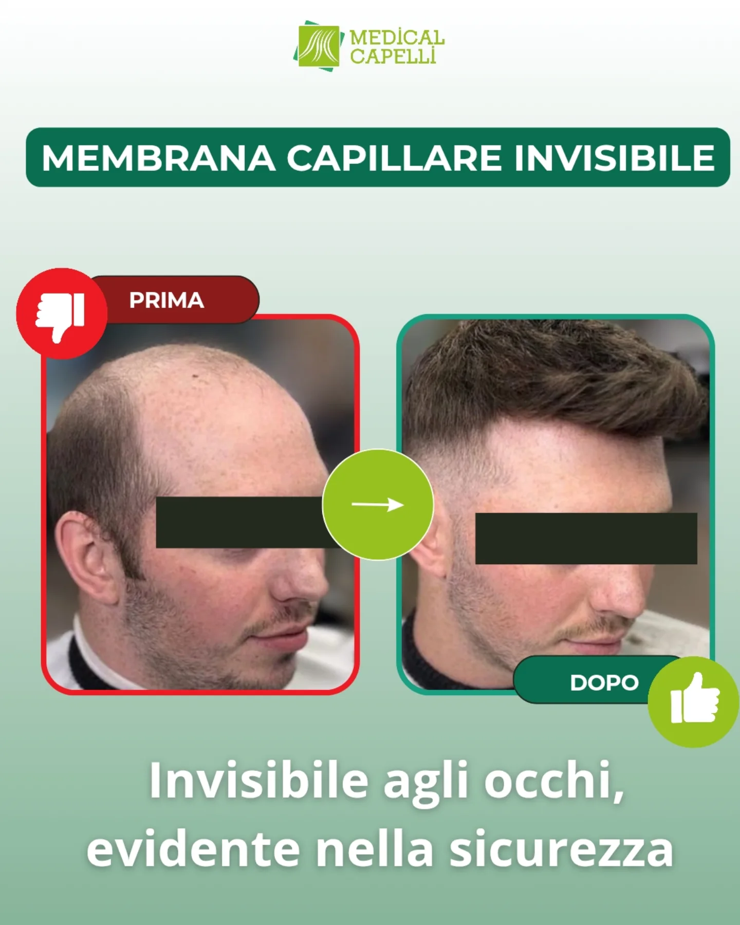 Membrana Capillare Invisibile Medical Capelli Palermo